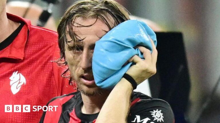AC Milan and Croatia midfielder Luke Modric holds an ice pack to his left cheek